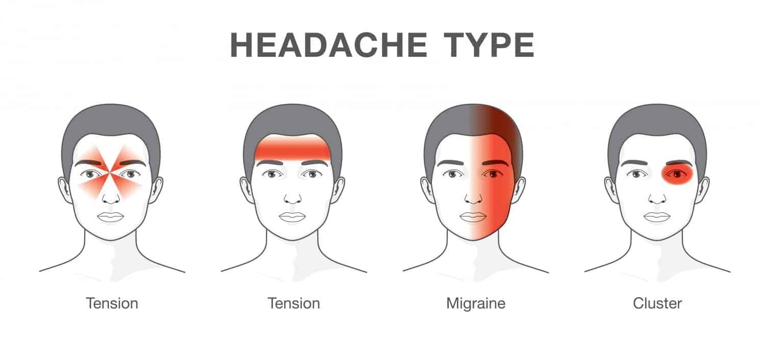 Headache-type-Gray headache type