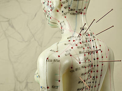 acupuncture-naturopathic-treatment-toronto acupuncture points