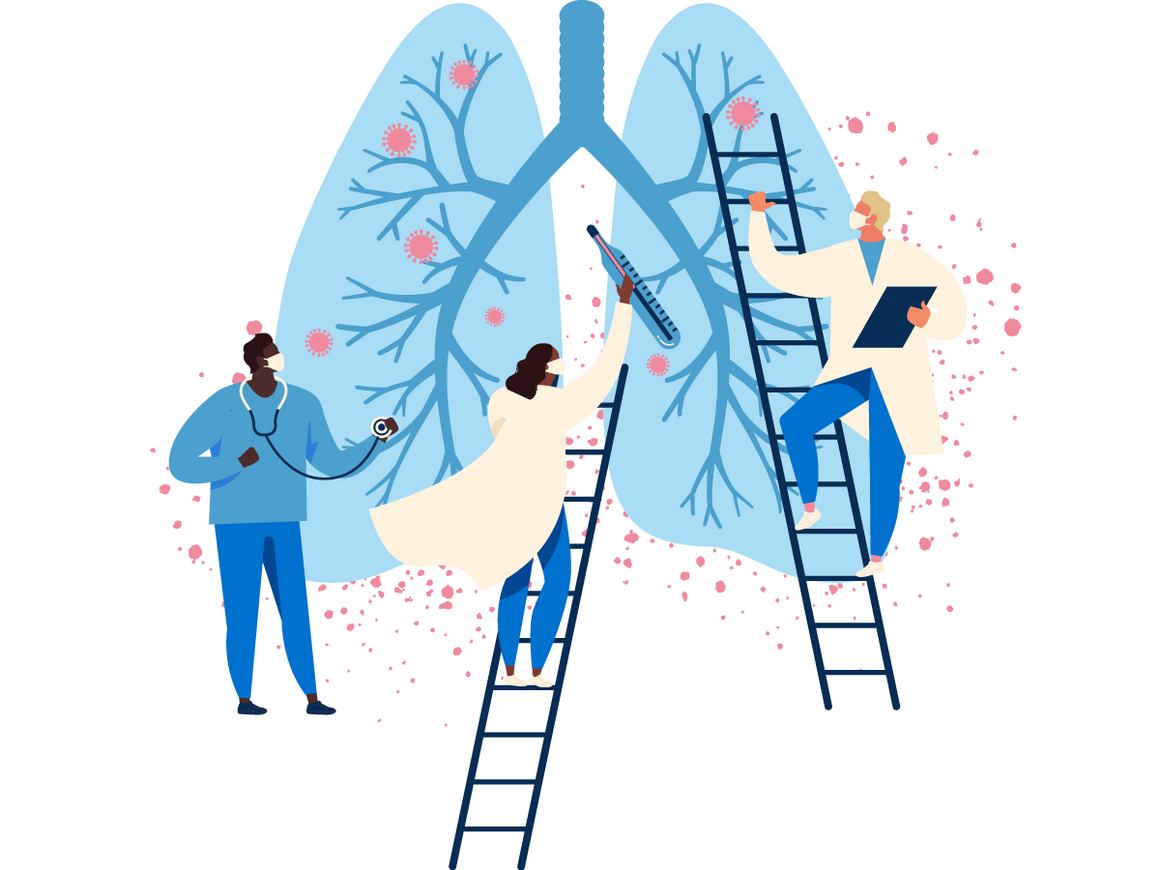 symptoms-covid-19 sequelae of Covid-19-lungs are pulmonary fibrosis