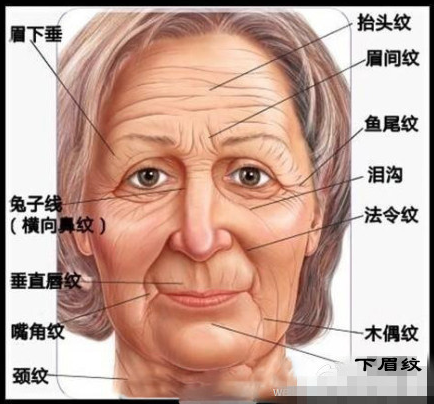 面部皱纹