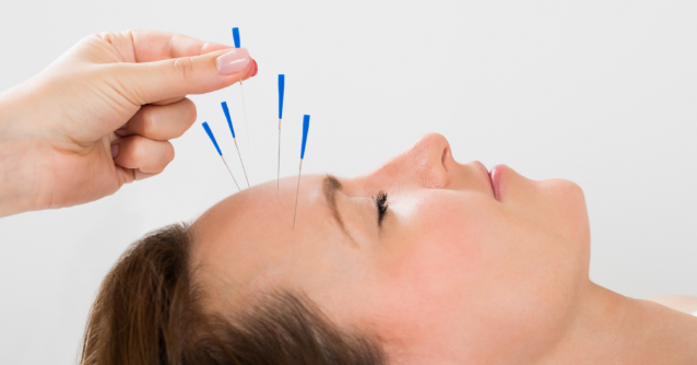 Acupuncture treat Headache acupuncture treat headach