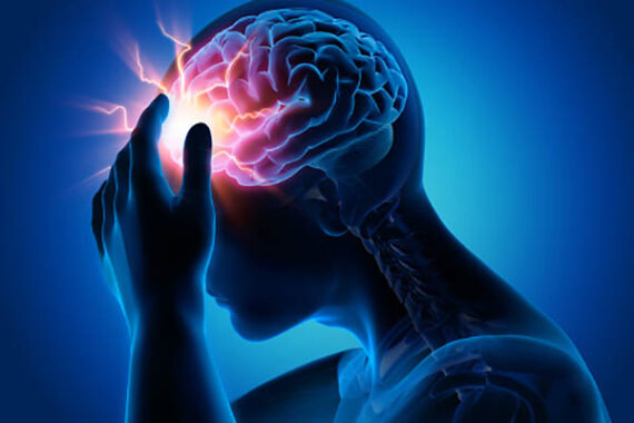 migraine